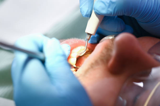 Best Emergency Dental Care for Broken or Chipped Teeth in Tiptonville, TN
